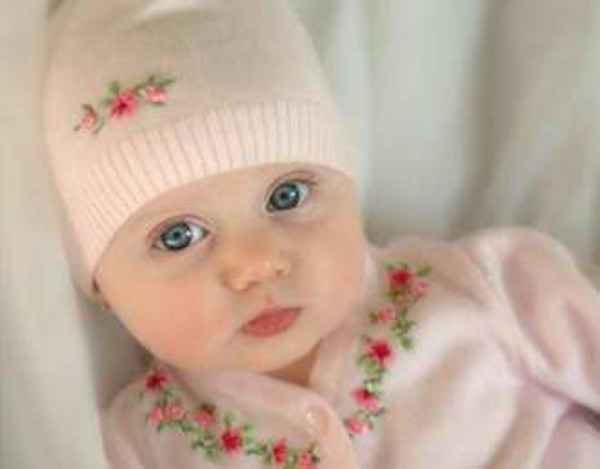 嬰兒右部痙攣性斜頸