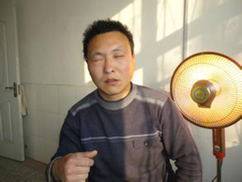 中年男性面肌痙攣