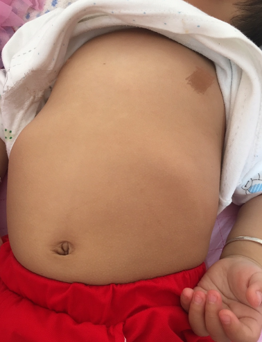 寶寶雞胸圖 (51) 