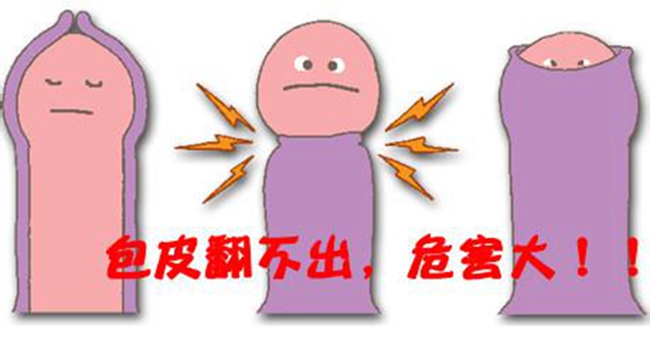 嵌頓包莖水腫不消 