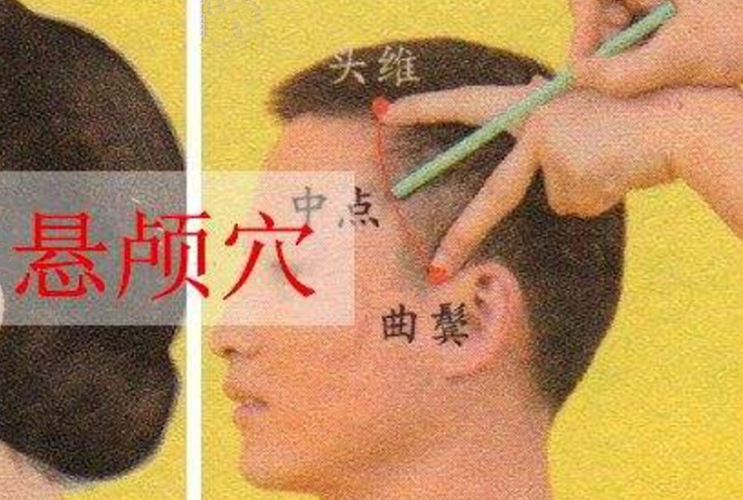 懸顱穴的頭部穴位