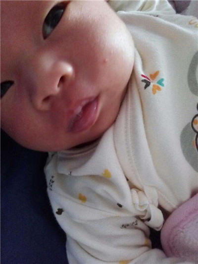 新生兒肺炎吐泡泡 (36) 