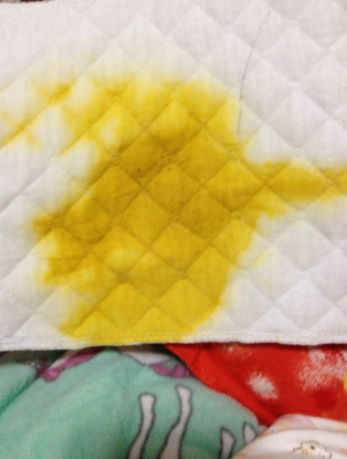 新生兒腹瀉大便