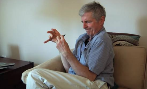 特發性震顫 (57) 