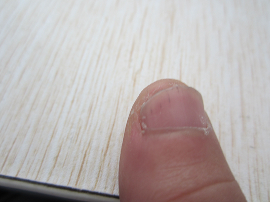 手指甲上有豎紋圖解 (6) 