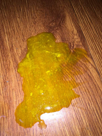 新生兒消化不良大便圖 (60) 