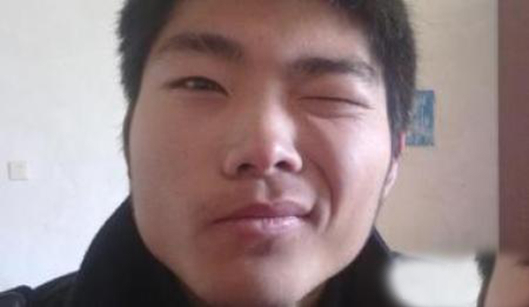 青年男性面肌痙攣