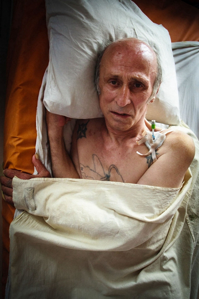 空洞型肺結核能活多久 (43) 