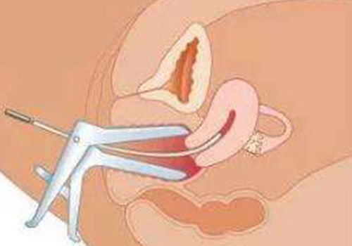 陰唇肥大漫畫_2 