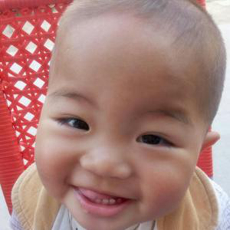 早期嬰幼兒腦炎