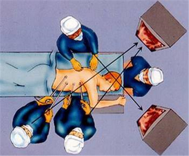 結核性胸膜炎診斷