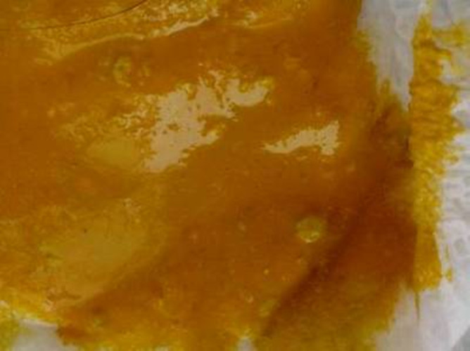 嬰兒母乳性腹瀉帶白泡沫狀大便