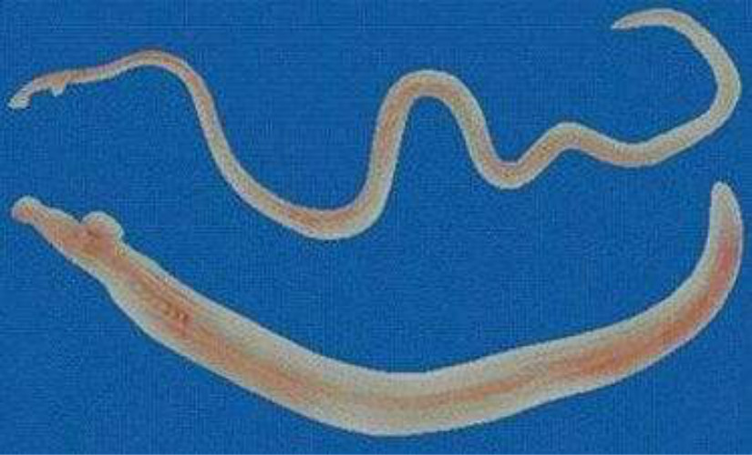 蛔蟲病蛔蟲外形 