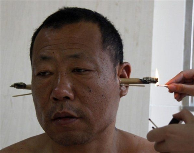 中醫治療腦萎縮