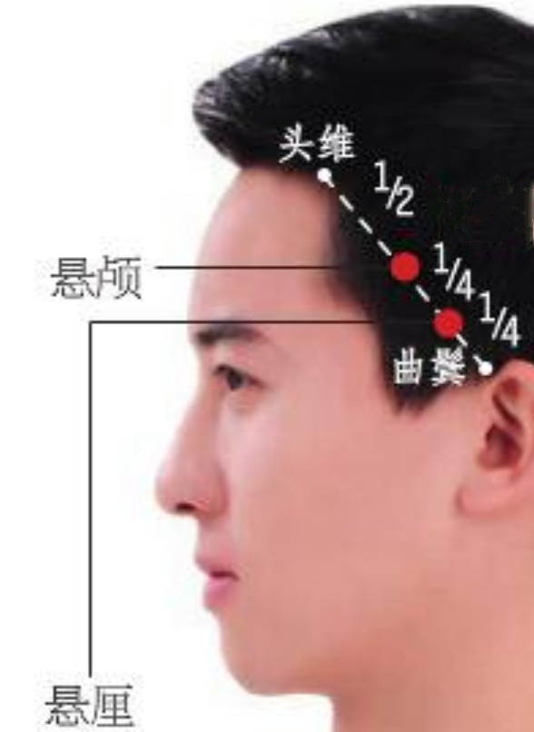 懸顱穴頭部穴位
