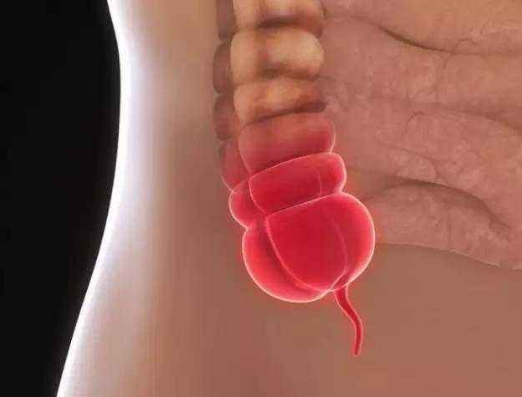 闌尾炎的症狀表現 (6) 