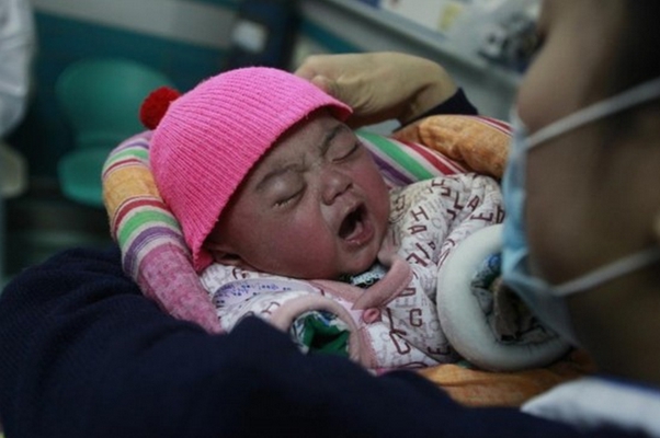 嬰兒嘴唇發紫 (49) 