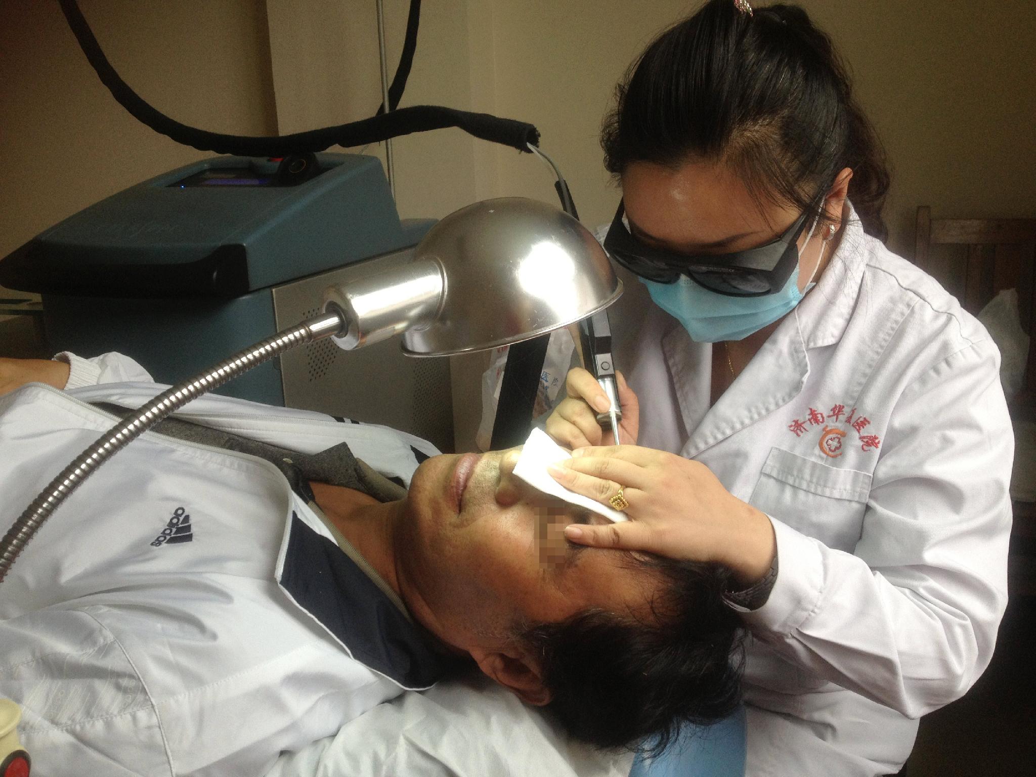 激光治療太田痣