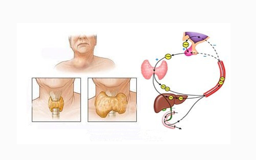 甲亢脖子症狀