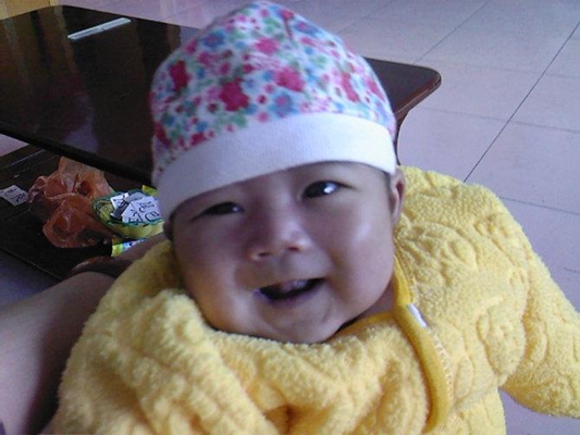 嬰兒嘴唇發紫 (51) 