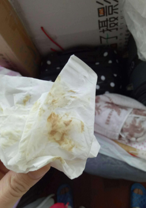 白帶帶有褐色分泌物 (62) 