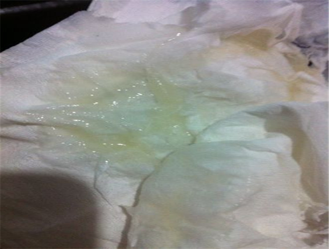 正常精子密度是多少 