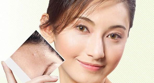 磨皮手術效果圖 (6) 