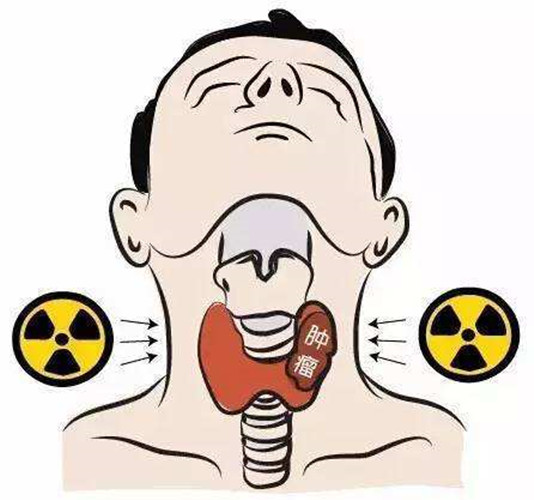 什麼是甲狀腺癌 