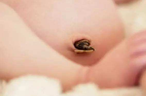 寶寶臍帶脫落後