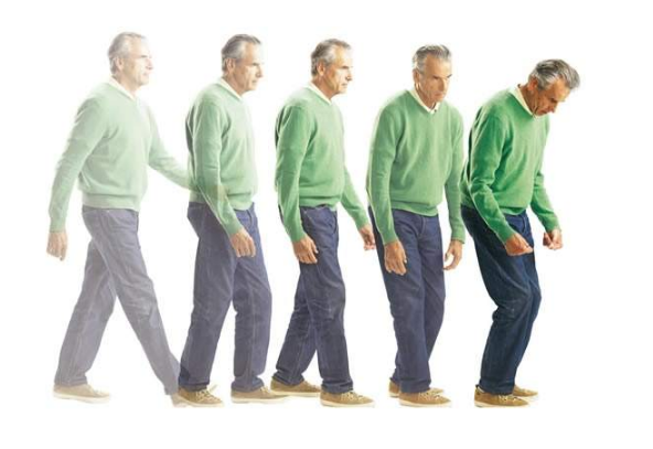 特發性震顫 (54) 