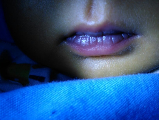 嬰兒嘴唇發紫 (8) 