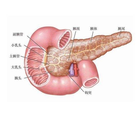 胰腺炎的症狀及圖解 (8) 