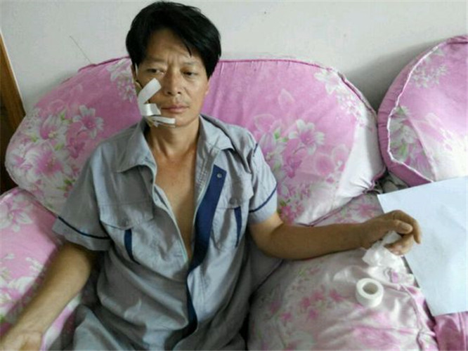 治療面癱偏方貼膏藥的