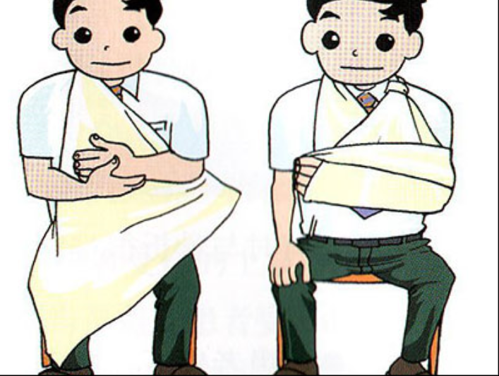 肋骨骨折的包紮方法 