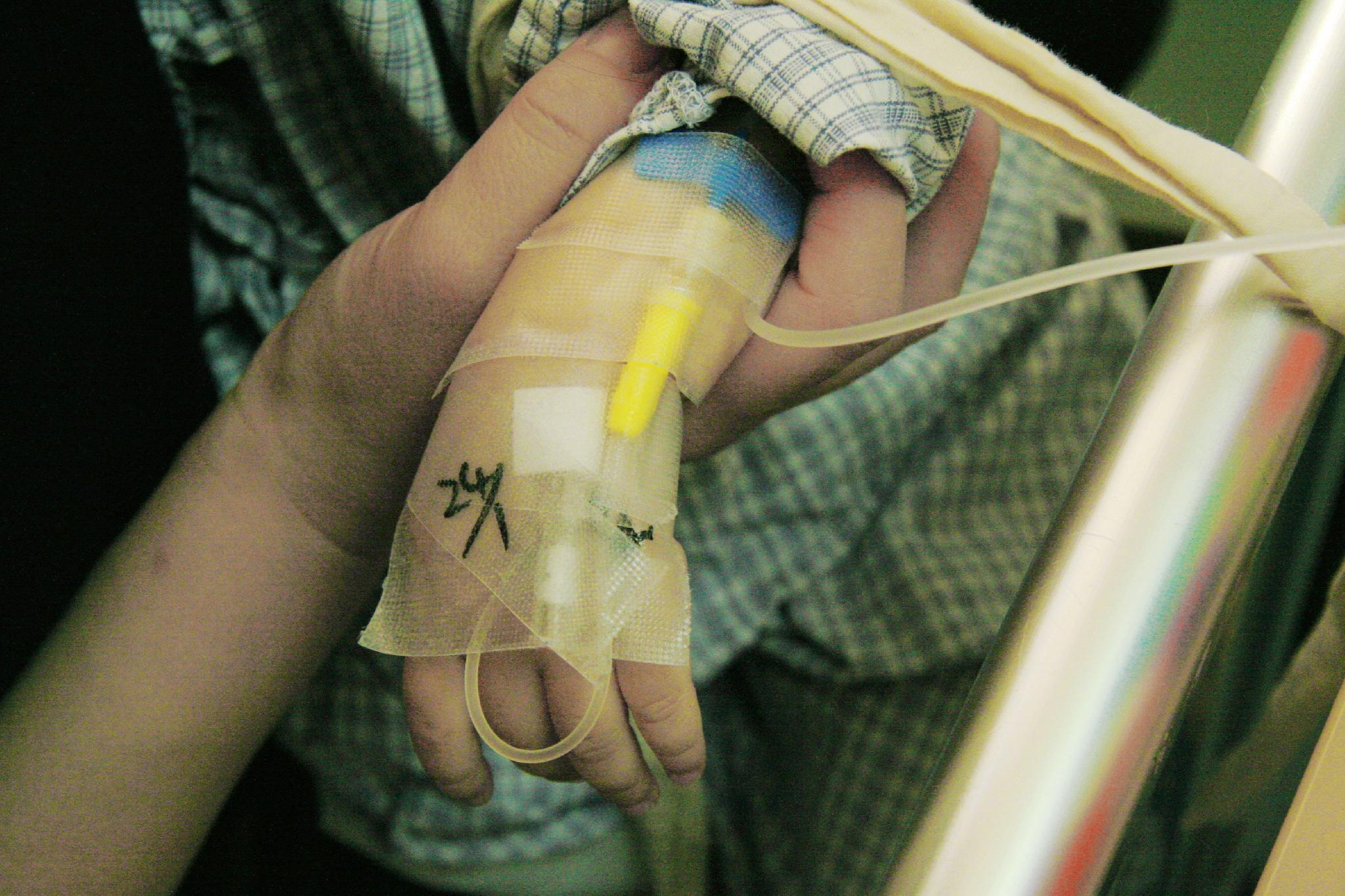 ＿小兒肺纖維化治療