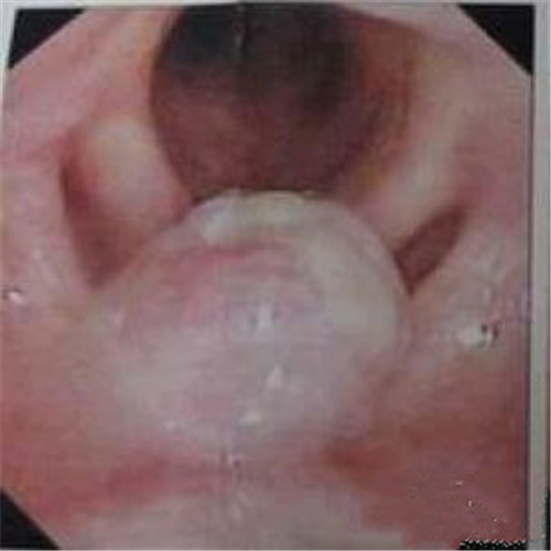 呼吸道感染口腔內部發炎