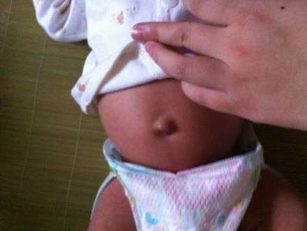 寶寶臍帶脫落後