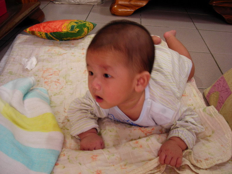 這個是不是痙攣性斜頸的