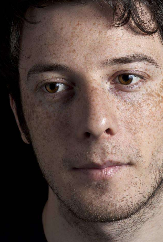 男人臉上長斑的