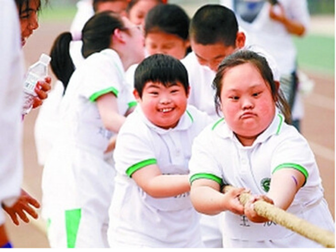 小孩唐氏綜合症