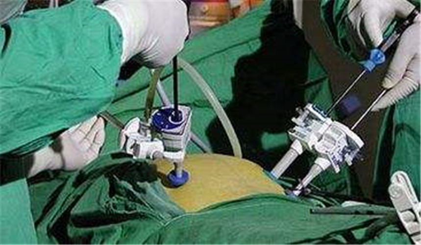 微創治療腎囊腫