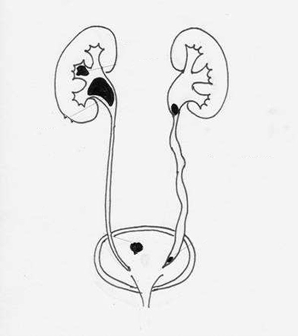 男性泌尿系統圖解 