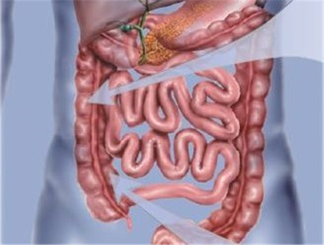 什麼是克羅恩病