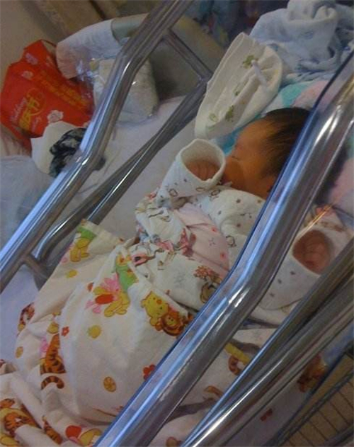 新生兒先天性喉喘鳴的