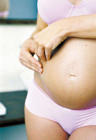 孕婦膽汁淤積症狀