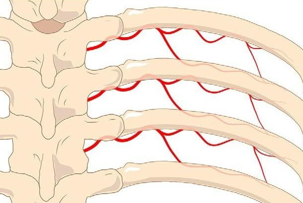 肋間神經炎疼痛部位