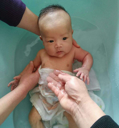 嬰兒肌張力高 (50) 