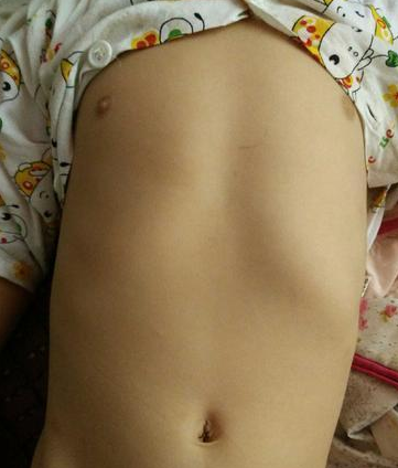 寶寶雞胸圖 (45) 