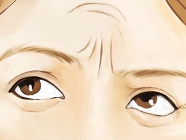 皮膚老化的漫畫卡通 