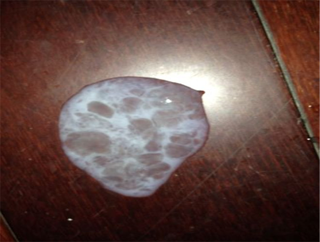 正常精子數是多少 